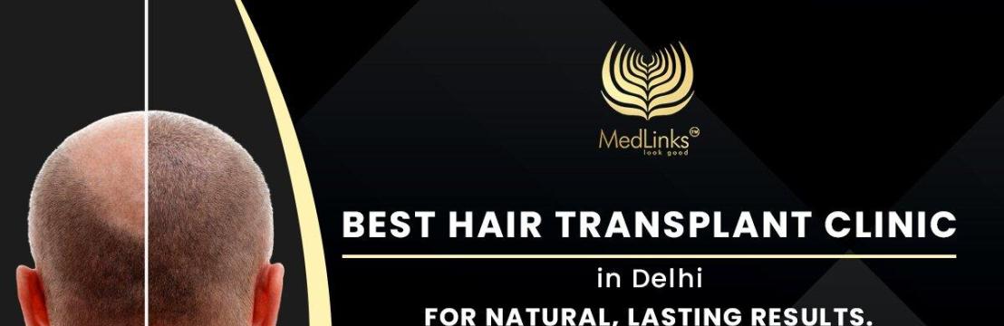 Hair Transplant Medlinks